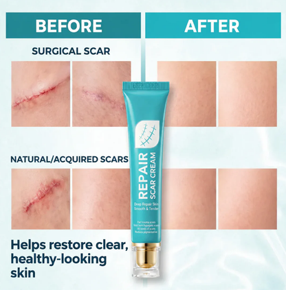 Scar Repair Cream