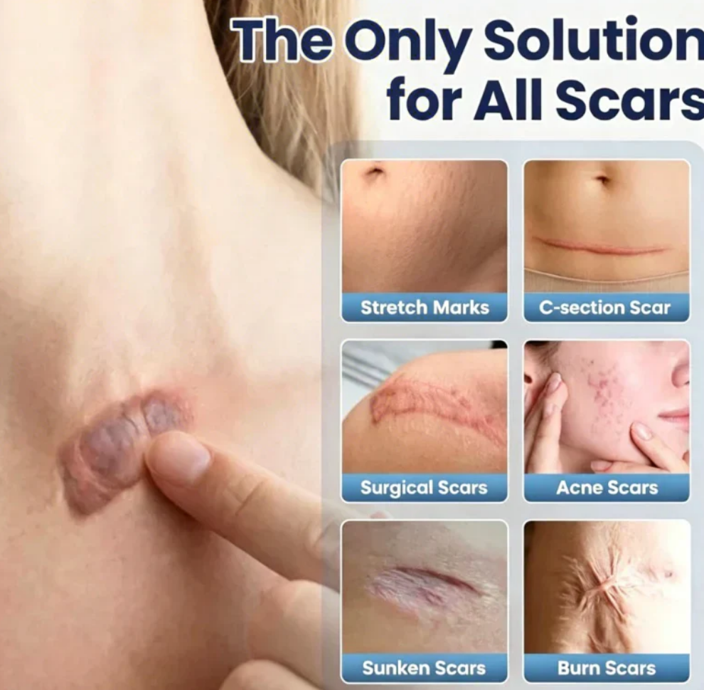 Scar Repair Cream