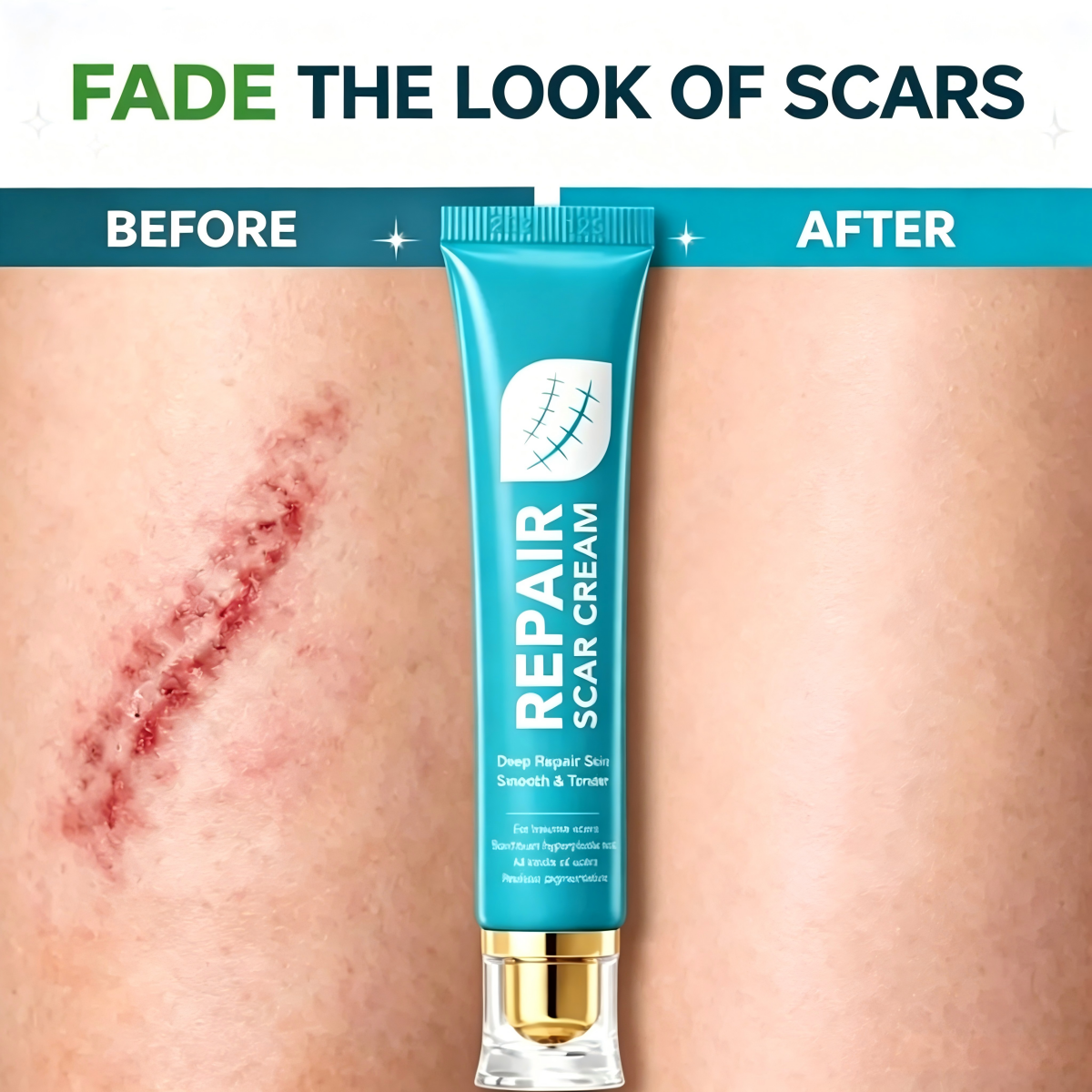 Scar Repair Cream