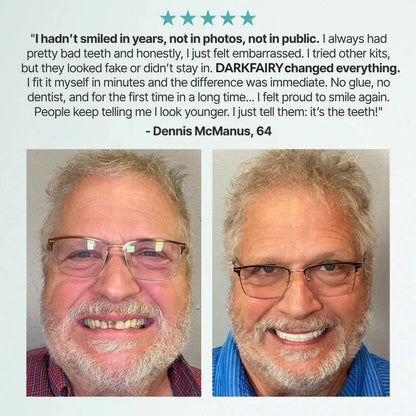 Custom-Fit Dentures - Designed for Comfort and a Natural-Looking Smile